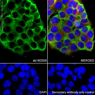 Immunocytochemistry/ Immunofluorescence - Anti-RPL9 antibody [EP13752] (AB182556)