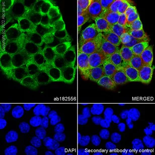Immunocytochemistry/ Immunofluorescence - Anti-RPL9 antibody [EP13752] (AB182556)