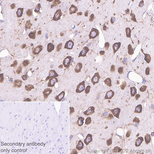 Immunohistochemistry (Formalin/PFA-fixed paraffin-embedded sections) - Anti-RPL9 antibody [EP13752] (AB182556)