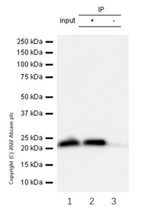 Immunoprecipitation - Anti-RPL9 antibody [EP13752] (AB182556)