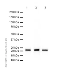 Western blot - Anti-RPL9 antibody [EP13752] (AB182556)
