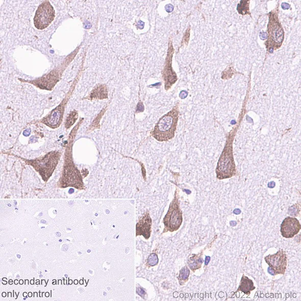 Immunohistochemistry (Formalin/PFA-fixed paraffin-embedded sections) - Anti-RPL9 antibody [EP13752] - BSA and Azide free (AB284834)