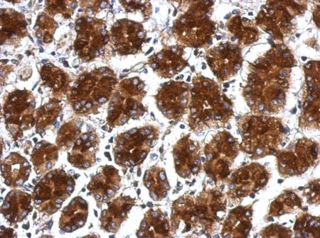 Immunohistochemistry (Formalin/PFA-fixed paraffin-embedded sections) - Anti-RPLP0 antibody (AB154970)