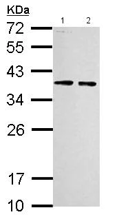 Western blot - Anti-RPLP0 antibody (AB154970)