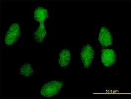 Immunocytochemistry/ Immunofluorescence - Anti-RPLP0 antibody (AB88872)