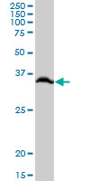 Western blot - Anti-RPLP0 antibody (AB88872), expandable thumbnail