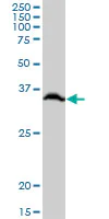 Western blot - Anti-RPLP0 antibody (AB88872)