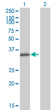 Western blot - Anti-RPLP0 antibody (AB88872), expandable thumbnail
