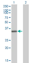 Western blot - Anti-RPLP0 antibody (AB88872)