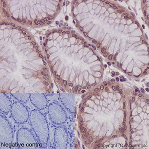 Immunohistochemistry (Formalin/PFA-fixed paraffin-embedded sections) - Anti-RPLP0 antibody [EP15646] (AB192866)