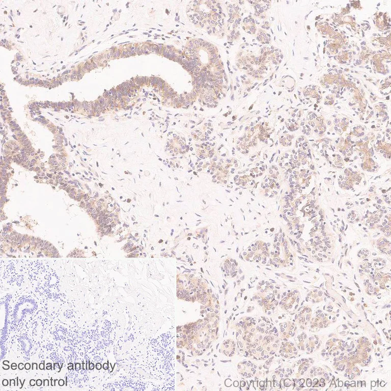 Immunohistochemistry (Formalin/PFA-fixed paraffin-embedded sections) - Anti-RPLP0 antibody [EP15646] (AB192866)