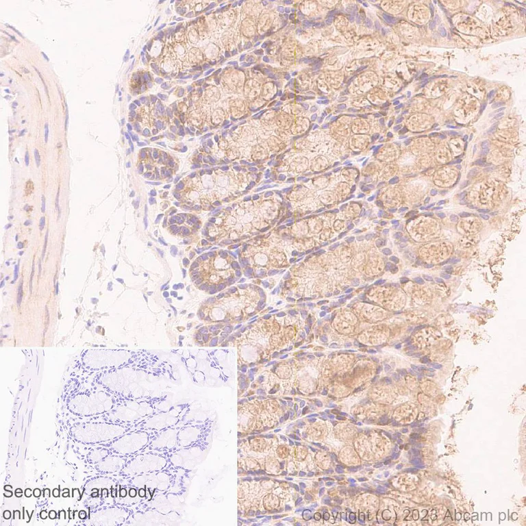 Immunohistochemistry (Formalin/PFA-fixed paraffin-embedded sections) - Anti-RPLP0 antibody [EP15646] (AB192866)