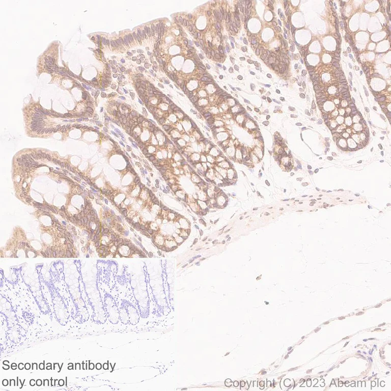 Immunohistochemistry (Formalin/PFA-fixed paraffin-embedded sections) - Anti-RPLP0 antibody [EP15646] (AB192866)