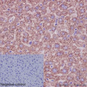 Immunohistochemistry (Formalin/PFA-fixed paraffin-embedded sections) - Anti-RPLP0 antibody [EP15646] (AB192866)