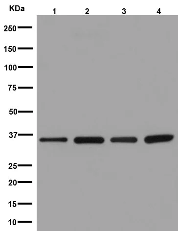 Western blot - Anti-RPLP0 antibody [EP15646] (AB192866)