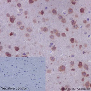 Immunohistochemistry (Formalin/PFA-fixed paraffin-embedded sections) - Anti-RPLP0 antibody [EP15646] - BSA and Azide free (AB236120)