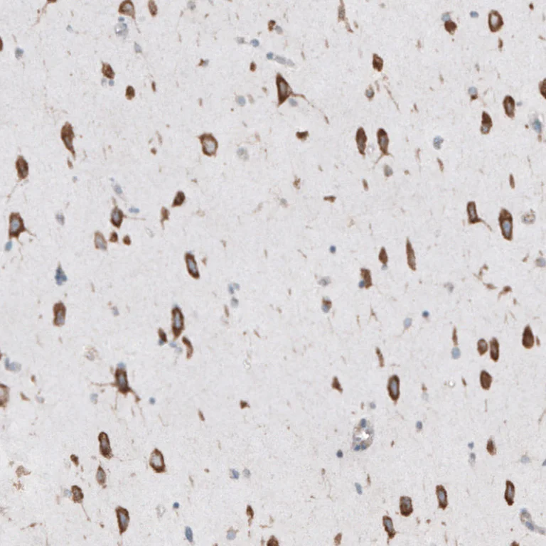 Immunohistochemistry (Formalin/PFA-fixed paraffin-embedded sections) - Anti-RPLP1 antibody (AB121190)