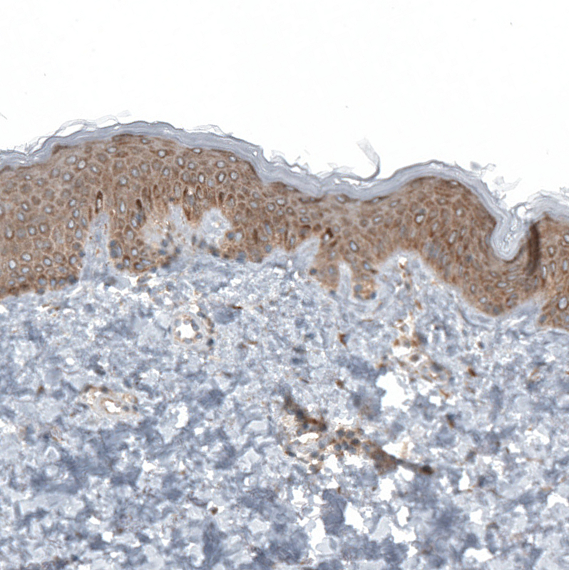 Immunohistochemistry (Formalin/PFA-fixed paraffin-embedded sections) - Anti-RPLP1 antibody (AB121190)
