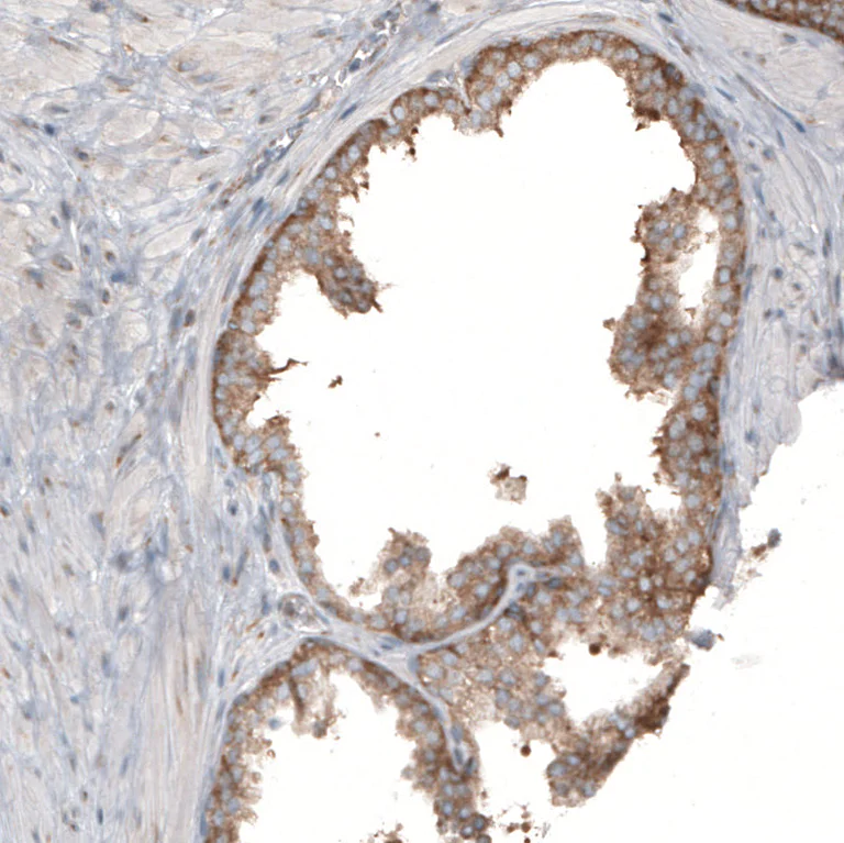 Immunohistochemistry (Formalin/PFA-fixed paraffin-embedded sections) - Anti-RPLP1 antibody (AB121190)