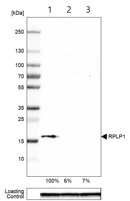 Western blot - Anti-RPLP1 antibody (AB121190)