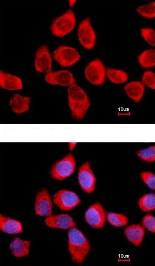 Immunocytochemistry/ Immunofluorescence - Anti-RPLP2 antibody (AB154958), expandable thumbnail
