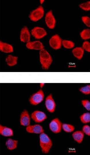 Immunocytochemistry/ Immunofluorescence - Anti-RPLP2 antibody (AB154958)