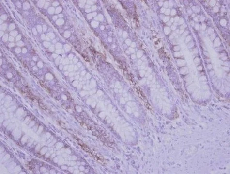 Immunohistochemistry (Formalin/PFA-fixed paraffin-embedded sections) - Anti-RPLP2 antibody (AB154958)