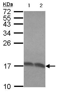 Western blot - Anti-RPLP2 antibody (AB154958), expandable thumbnail