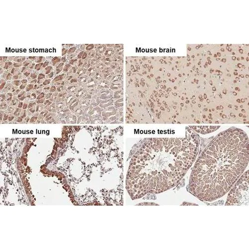 Immunohistochemistry (Formalin/PFA-fixed paraffin-embedded sections) - Anti-RPLP2 antibody [HL2256] (AB317179)