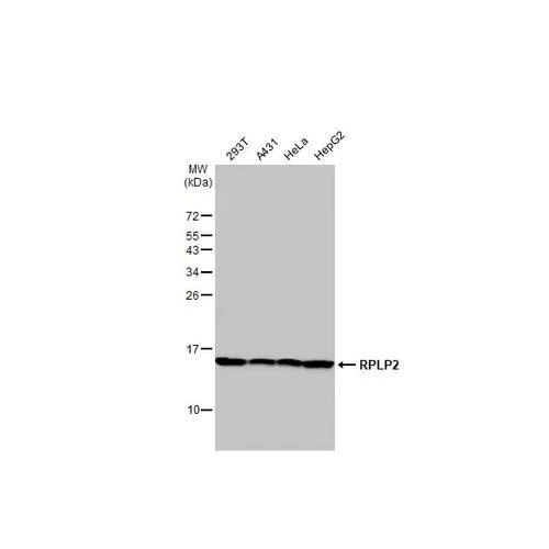 Western blot - Anti-RPLP2 antibody [HL2256] (AB317179)