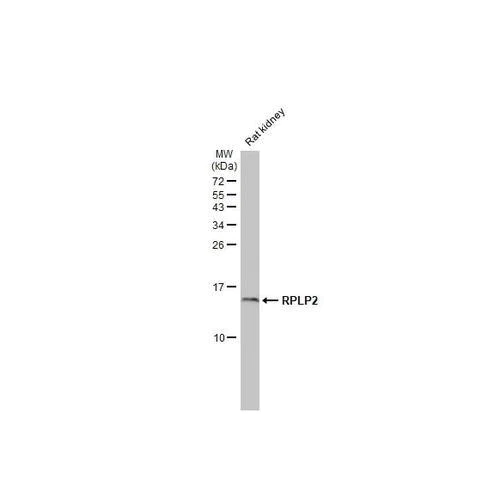 Western blot - Anti-RPLP2 antibody [HL2256] (AB317179)