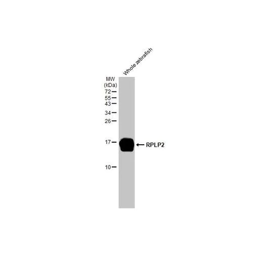 Western blot - Anti-RPLP2 antibody [HL2256] (AB317179)