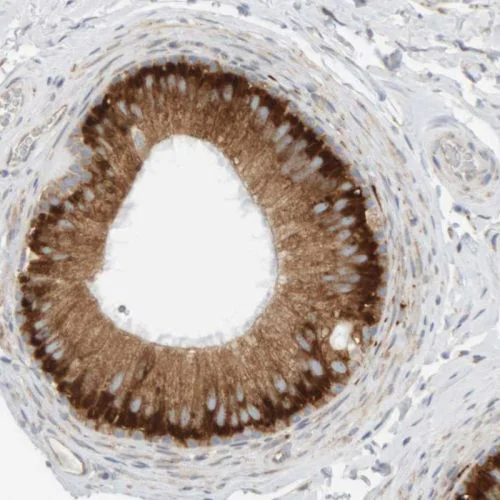 Immunohistochemistry (Formalin/PFA-fixed paraffin-embedded sections) - Anti-RPN2 antibody (AB244399)