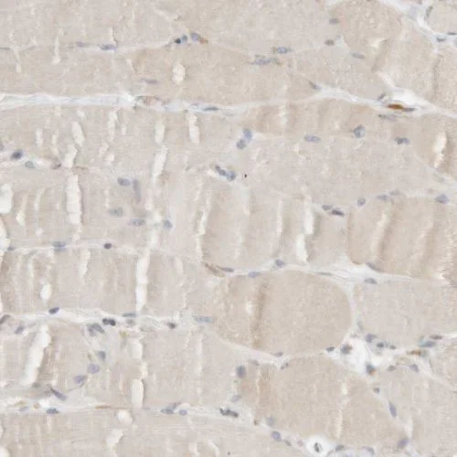 Immunohistochemistry (Formalin/PFA-fixed paraffin-embedded sections) - Anti-RPN2 antibody (AB244399)