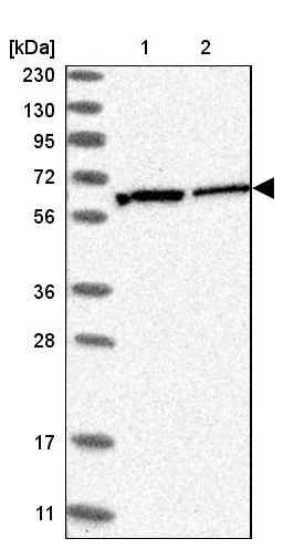 Western blot - Anti-RPN2 antibody (AB244399)