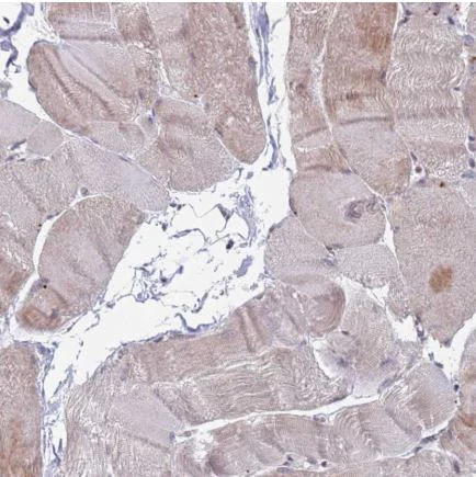 Immunohistochemistry (Formalin/PFA-fixed paraffin-embedded sections) - Anti-RPP25 antibody (AB126338)