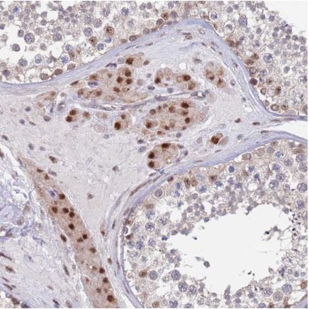 Immunohistochemistry (Formalin/PFA-fixed paraffin-embedded sections) - Anti-RPP25 antibody (AB126338), expandable thumbnail