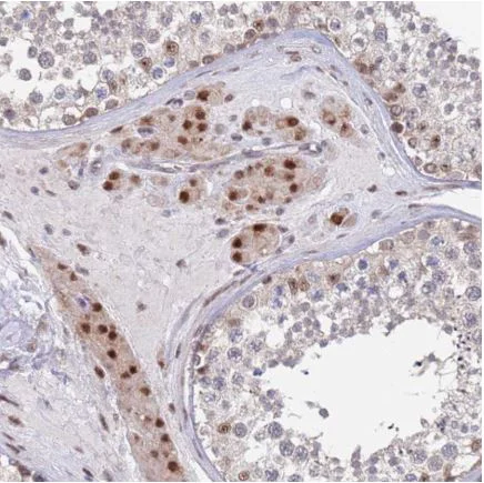 Immunohistochemistry (Formalin/PFA-fixed paraffin-embedded sections) - Anti-RPP25 antibody (AB126338)