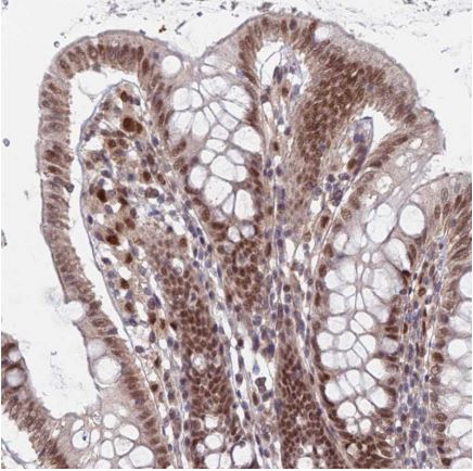 Immunohistochemistry (Formalin/PFA-fixed paraffin-embedded sections) - Anti-RPP25 antibody (AB126338), expandable thumbnail
