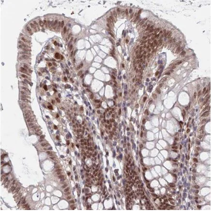 Immunohistochemistry (Formalin/PFA-fixed paraffin-embedded sections) - Anti-RPP25 antibody (AB126338)