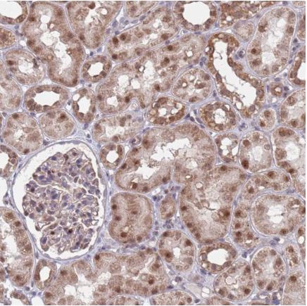 Immunohistochemistry (Formalin/PFA-fixed paraffin-embedded sections) - Anti-RPP25 antibody (AB126338), expandable thumbnail