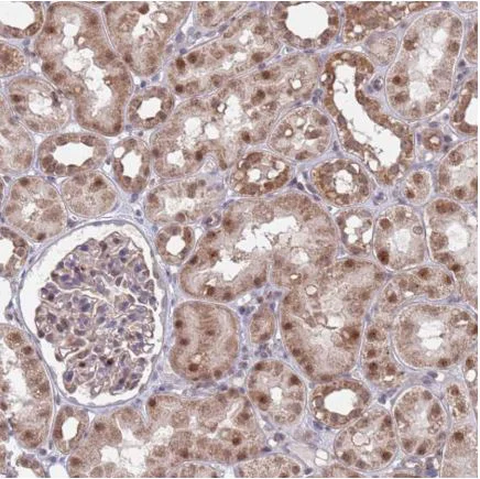 Immunohistochemistry (Formalin/PFA-fixed paraffin-embedded sections) - Anti-RPP25 antibody (AB126338)
