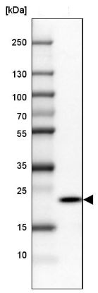 Western blot - Anti-RPP25 antibody (AB126338), expandable thumbnail