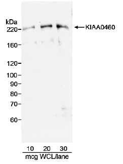 Western blot - Anti-RPRD2 antibody (AB10373)