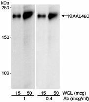 Western blot - Anti-RPRD2 antibody (AB17996), expandable thumbnail