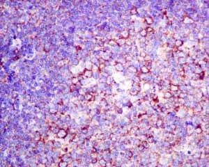 Immunohistochemistry (Formalin/PFA-fixed paraffin-embedded sections) - Anti-RPS10 antibody [EPR8545] (AB151550)