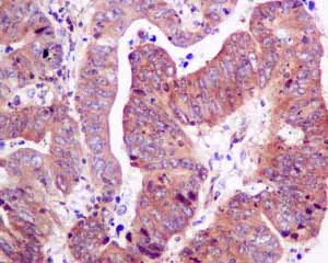 Immunohistochemistry (Formalin/PFA-fixed paraffin-embedded sections) - Anti-RPS10 antibody [EPR8545] (AB151550)