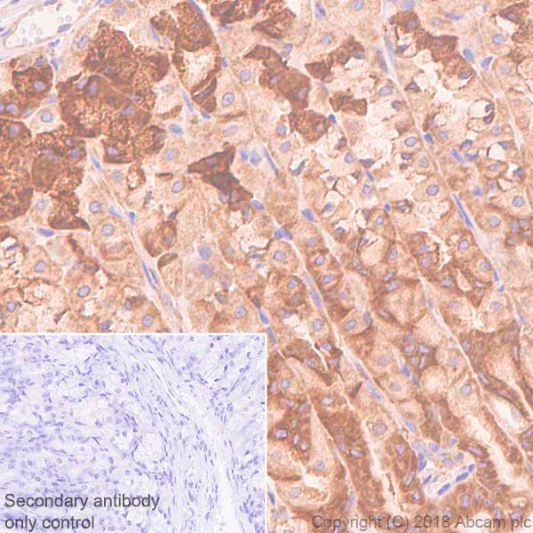 Immunohistochemistry (Formalin/PFA-fixed paraffin-embedded sections) - Anti-RPS10 antibody [EPR8545] (AB151550)