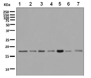 Western blot - Anti-RPS10 antibody [EPR8545] (AB151550)