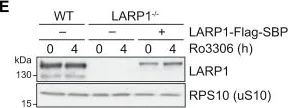 Western blot - Anti-RPS10 antibody [EPR8545] (AB151550)